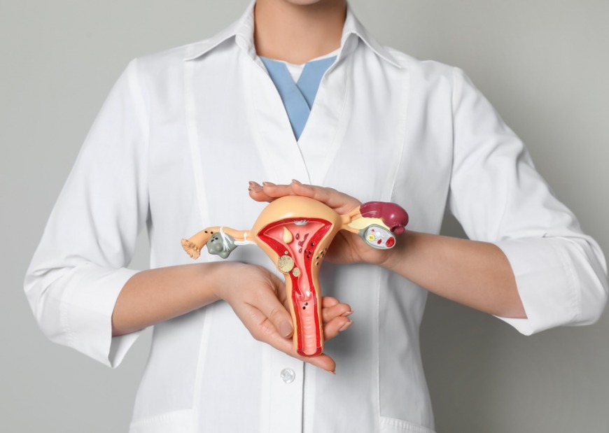 Endometriosis doctor in Dubai Endometriosis doctor in Dubai